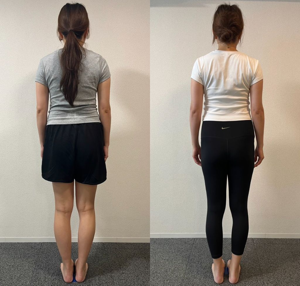 Before / After 写真（後ろ姿）