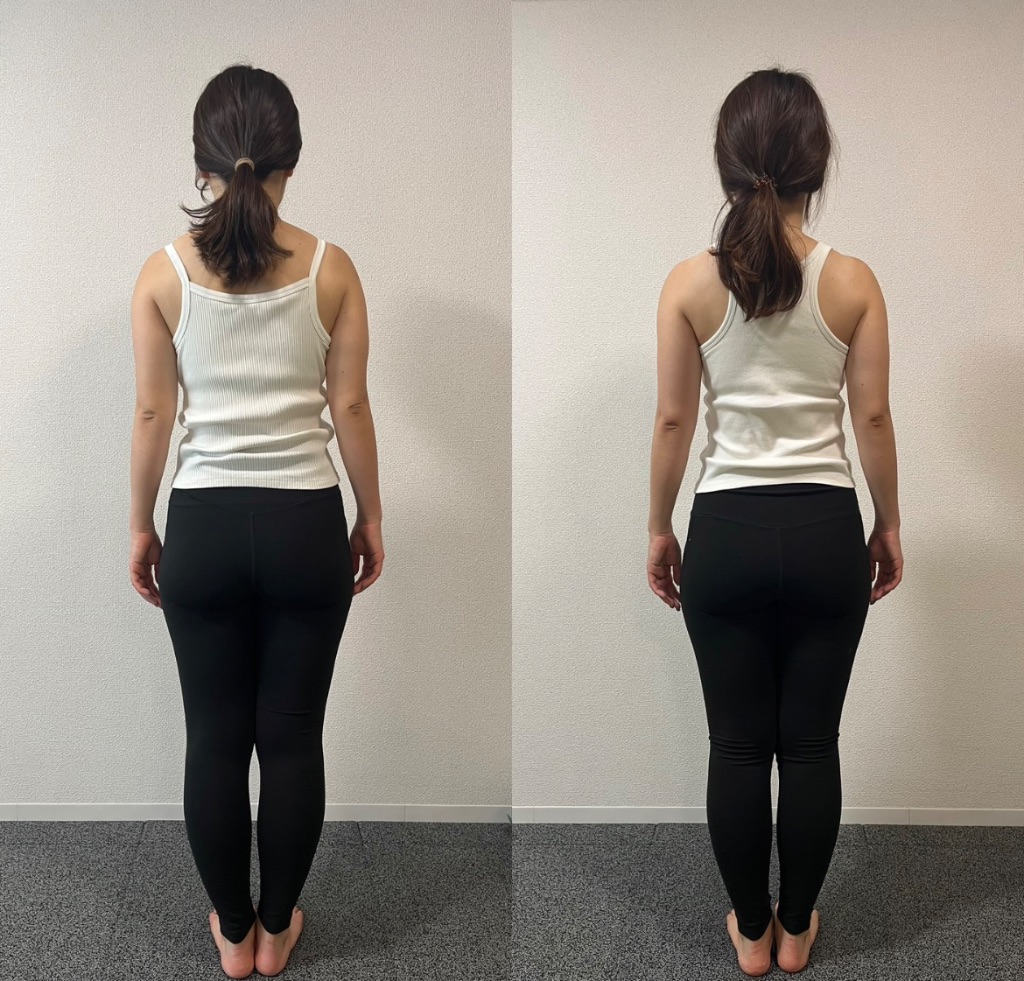 Before / After 写真（後ろ姿）