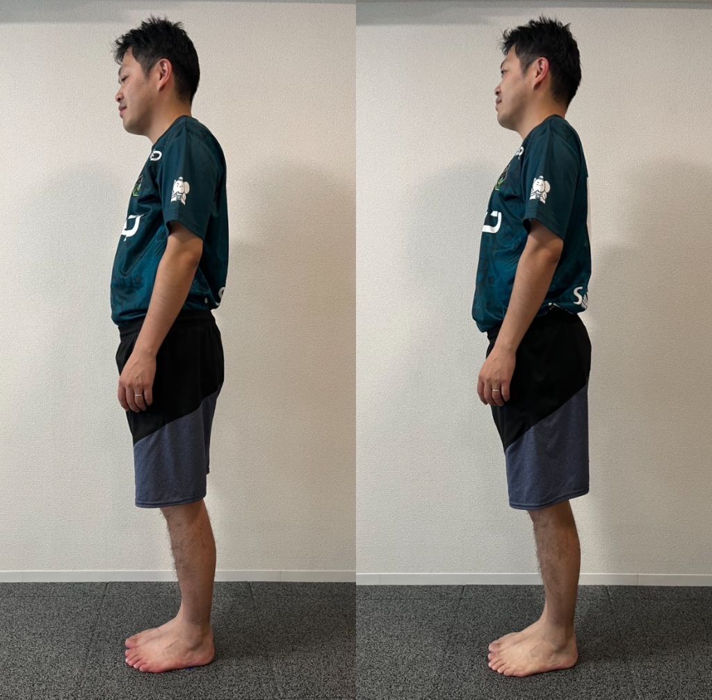 Before / After 写真（横向き）